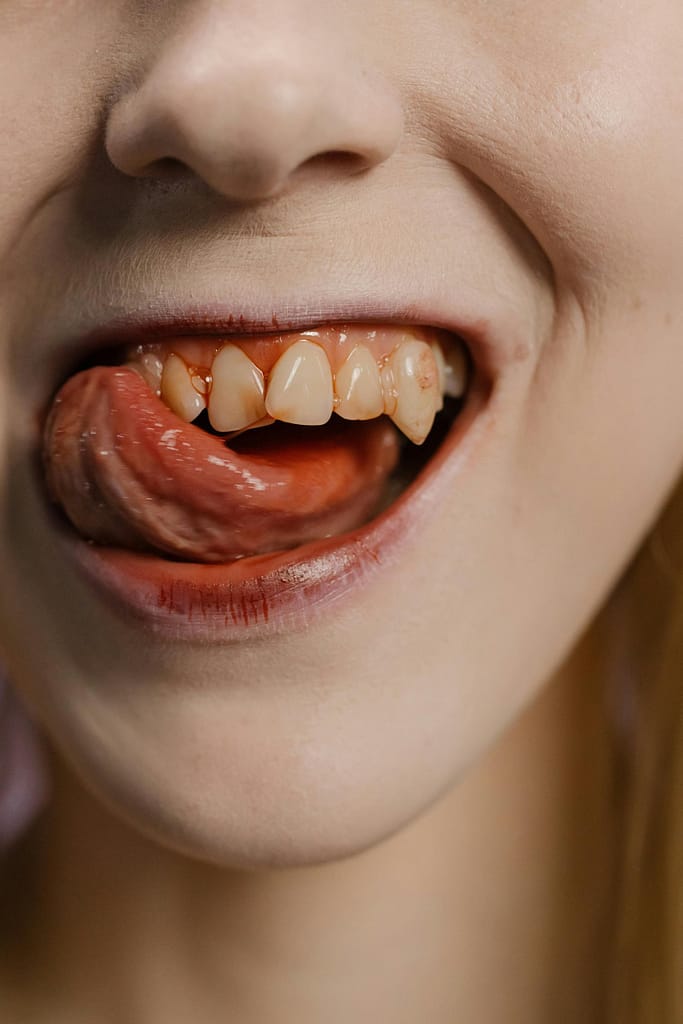 an image of bloody teeth.